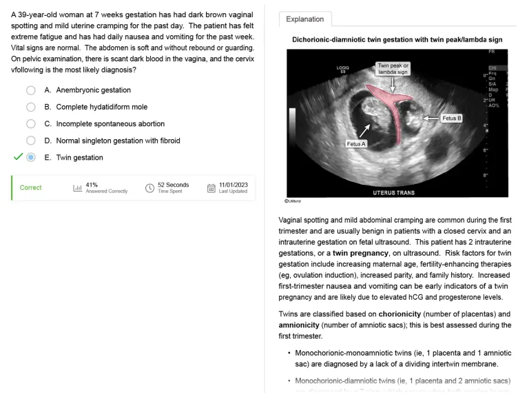 UWorld practice question & explanation example for Dichorionic-diamniotic twin gestation