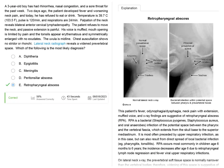 UWorld practice question & explanation example for Retropharyngeal abscess