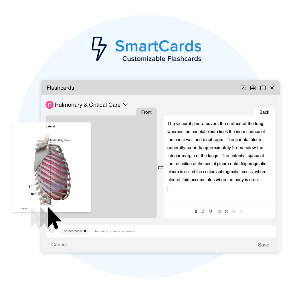 USMLE custom flashcard example featuring Pulmonary & Critical Care
